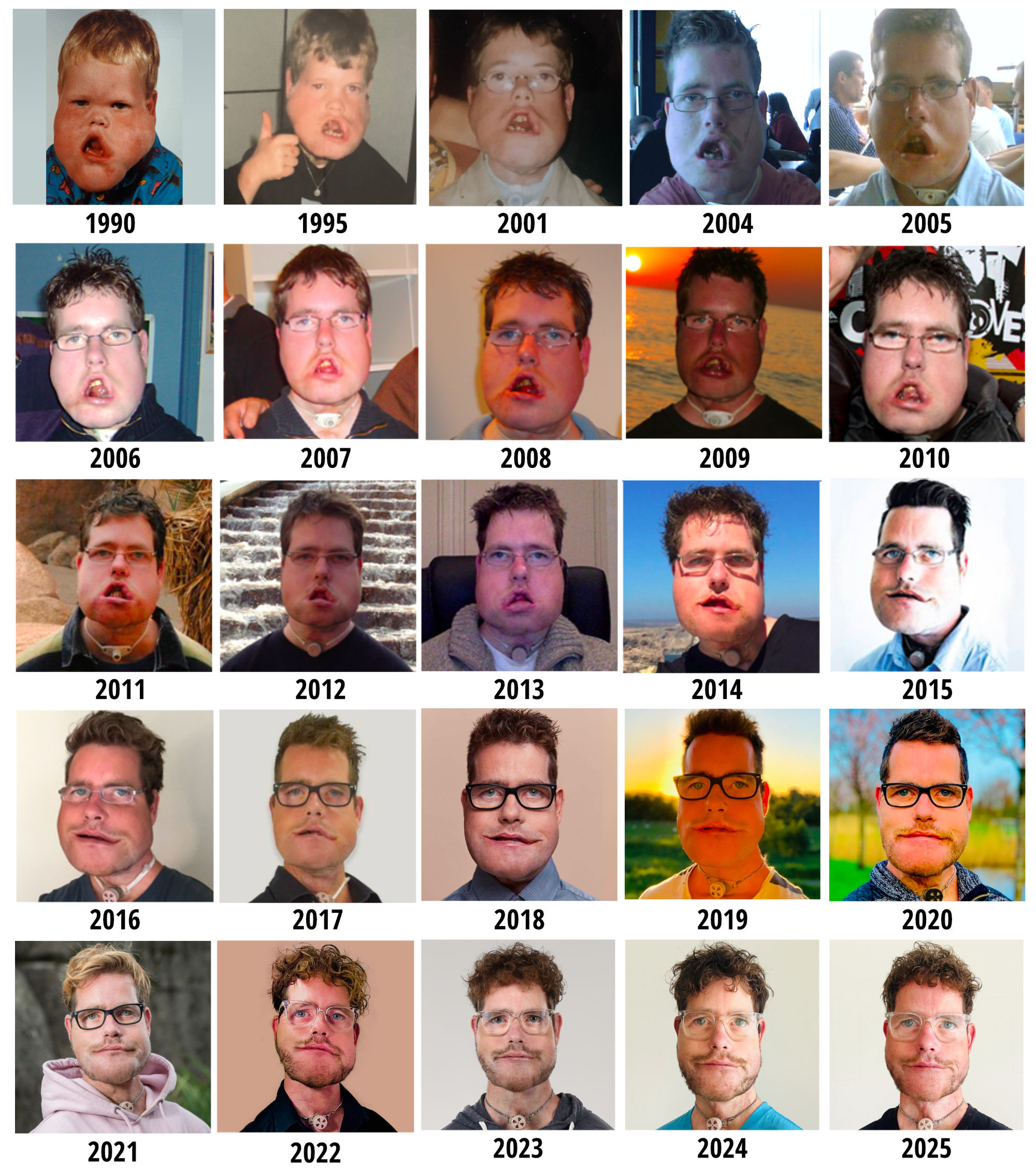 Photo Timeline